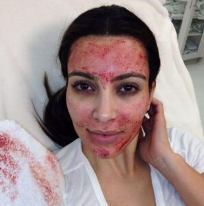 Vampire facial reimagine clinic