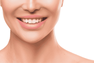 Teeth Whitening Treatment | Best Teeth Whitening Center in Laval, Quebec