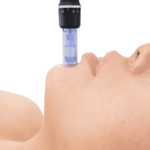 microneedling for blackhead extraction in montreal quebec