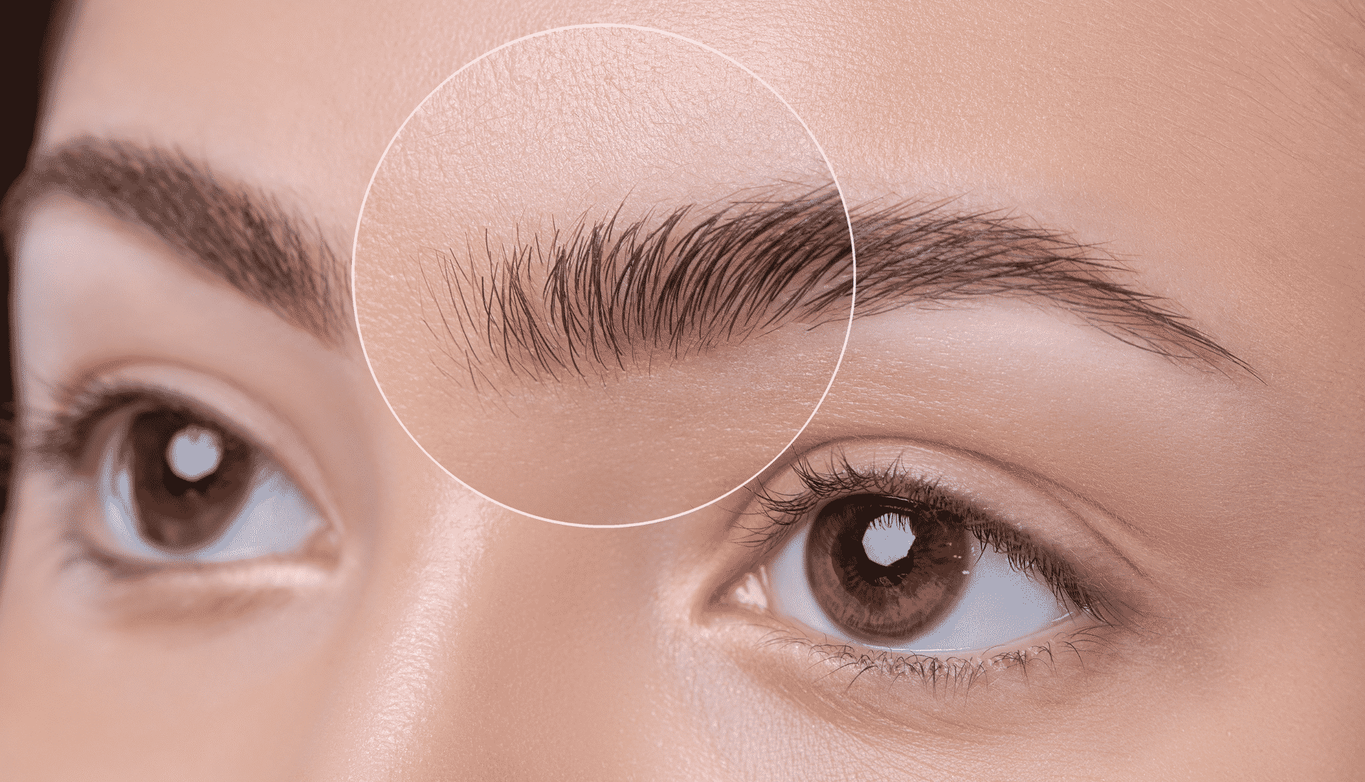 microblading removal in montreal and laval quebec