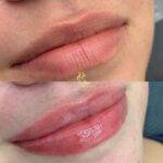lip blush montreal